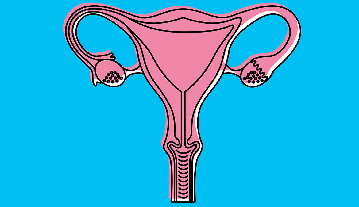 Scientists discover a new drug that could prevent ovarian cancer relapse for years